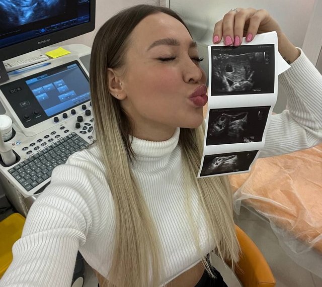 Полыгалова намерена получить миллион рублей за беременность?