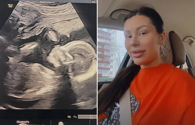 Алина Иордан: Животик растёт не по дням, а по часам Алина Иордан: Животик растёт не по дням, а по часам