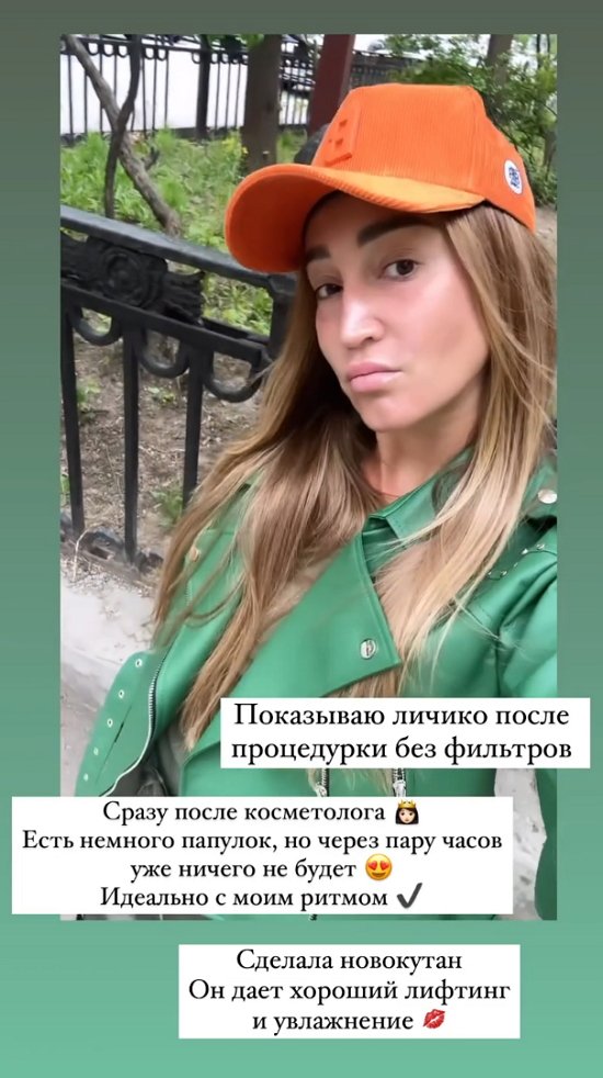 Бузова похвасталась своим лицом без фильтров после похода к косметологу