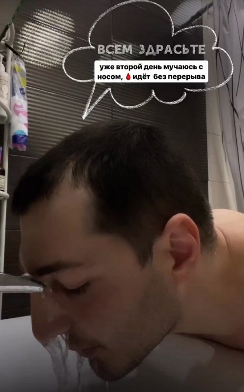 Иосиф Оганесян: Второй день мучаюсь с носом