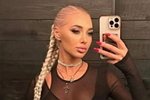 Анастасия Стецевят: Я к Диме отношусь хорошо
