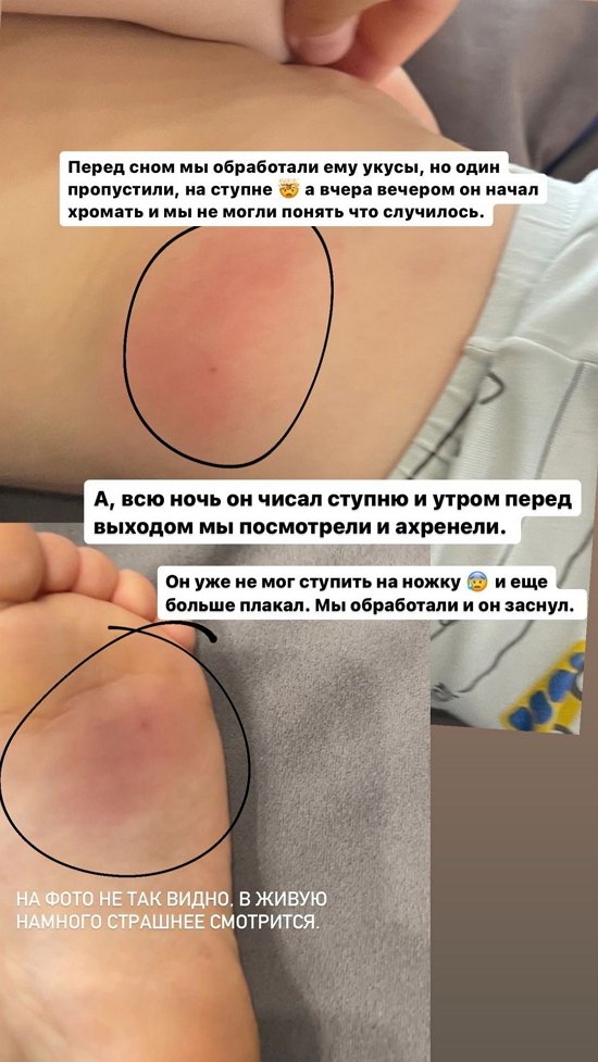 Иосиф Оганесян: Он не мог ступить на ножку