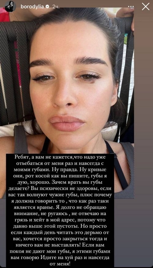 Ксения Бородина: Нормальным людям не до обсуждения чужих губ