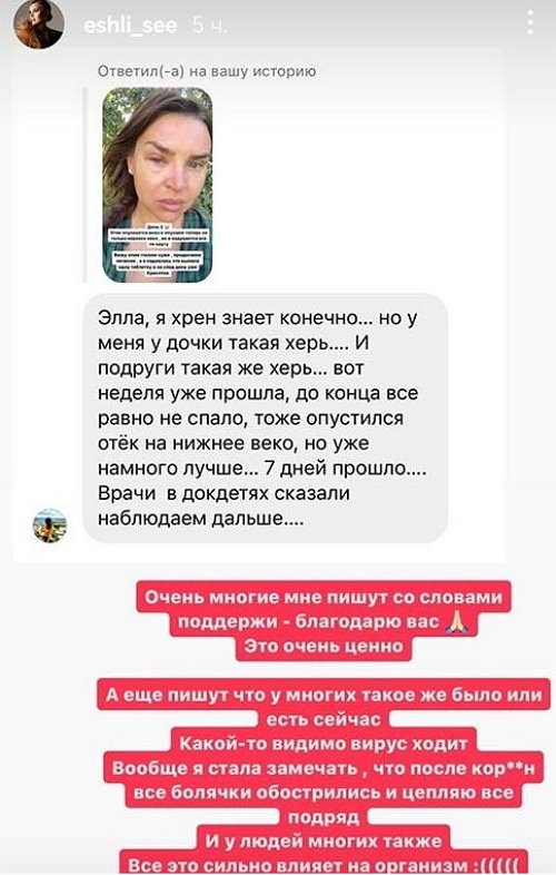 Элла Суханова: Стало хуже