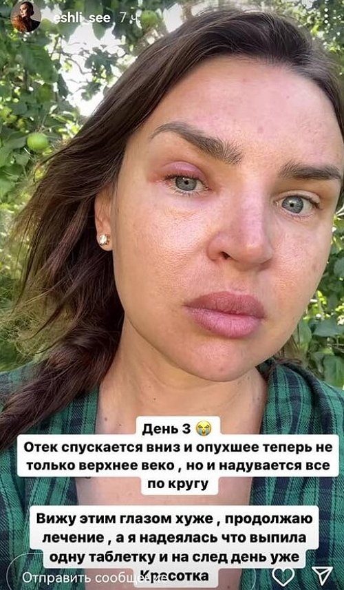 Элла Суханова: Стало хуже