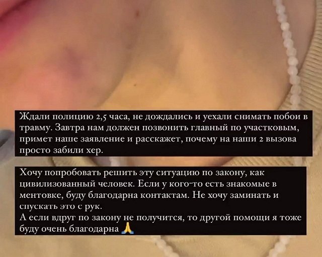 Анна Кручинина: Не хочу спускать это с рук