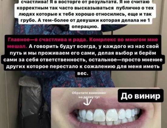 Фолловеров шокировали новые зубы Иры Пингвиновой