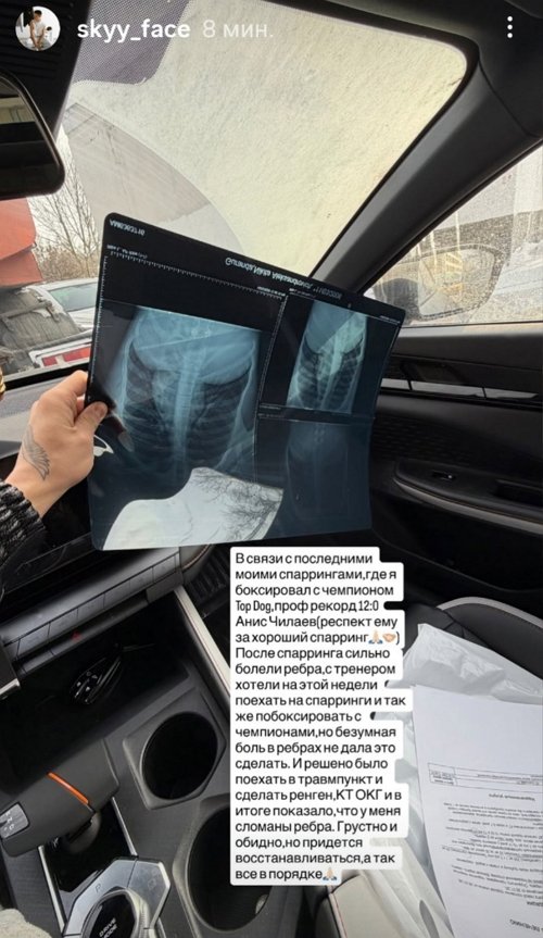 Никита Гуранда получил травму рёбер