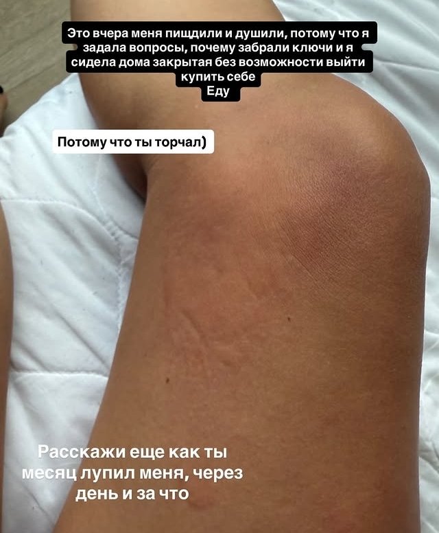 Анастасия Стецевят: Я ушла из дома, чтобы нас не убили