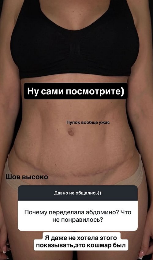 Ирина Пинчук: Это был кошмар