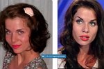 До и После: пластические операции участниц