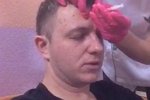 Илья Яббаров решил избавиться от морщин