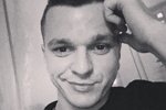Антон Гусев сделал коррекцию век