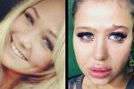 Фотографии Марии Кохно до пластики